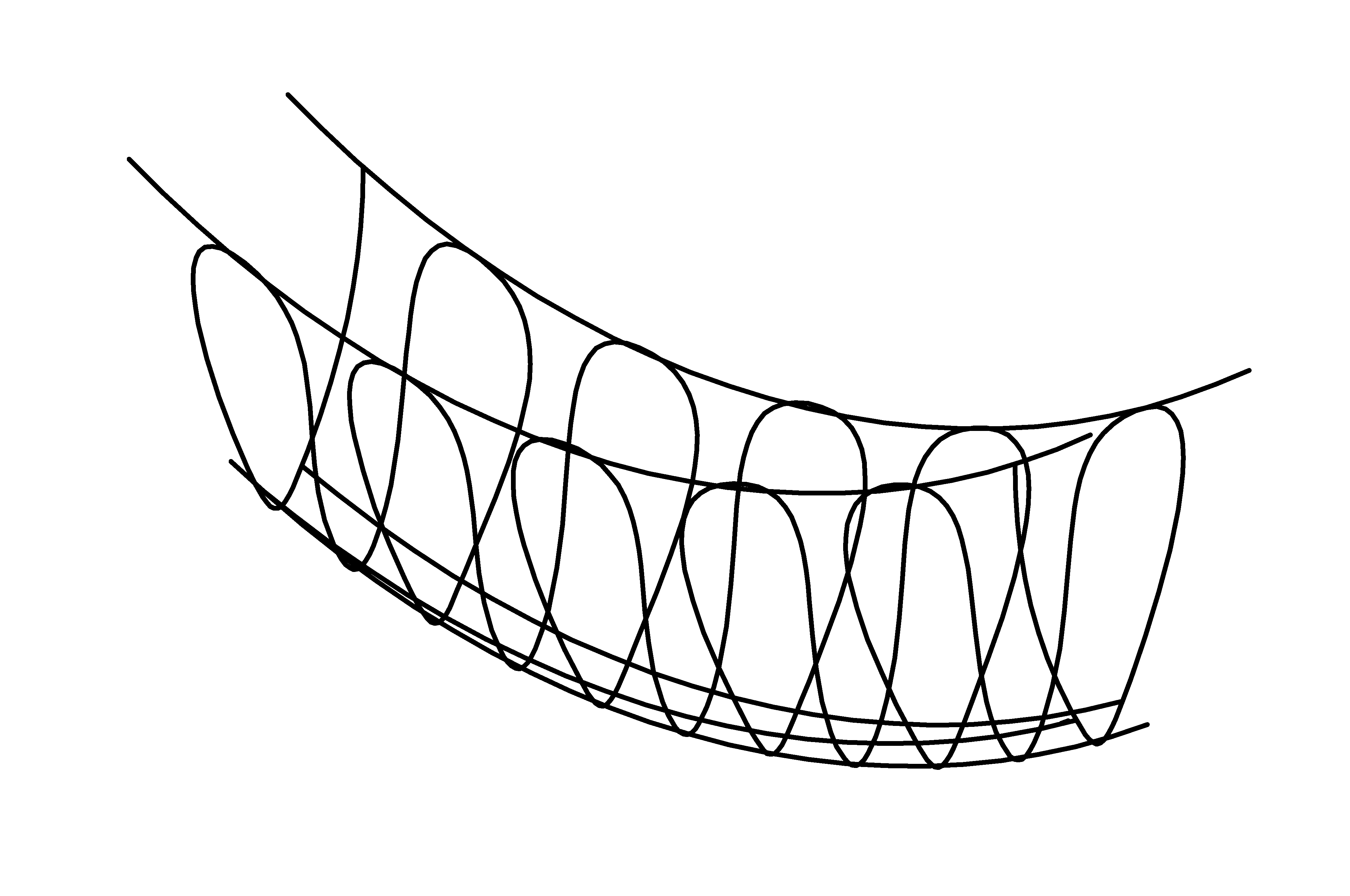 Rope Bridge, red, length = 2 m